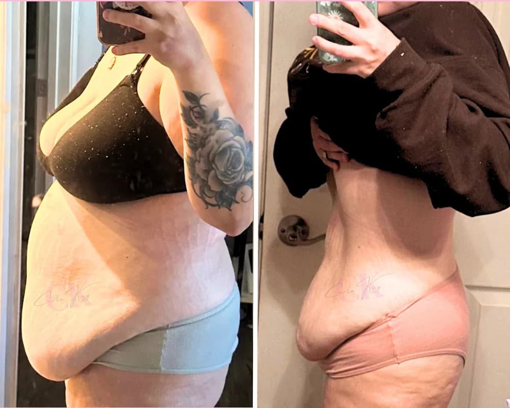 Before and after transformation result