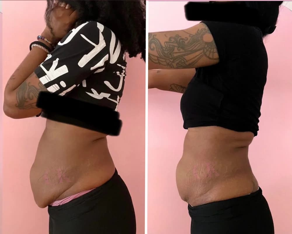 Before and after transformation result
